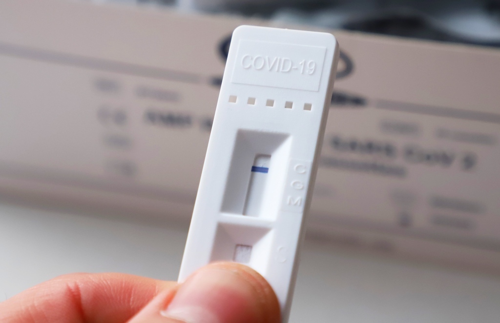 Pagal COVID-19 susirgimus Šiauliai – vieni pirmųjų šalyje, Savivaldybė prašo verslo bendradarbiavimo